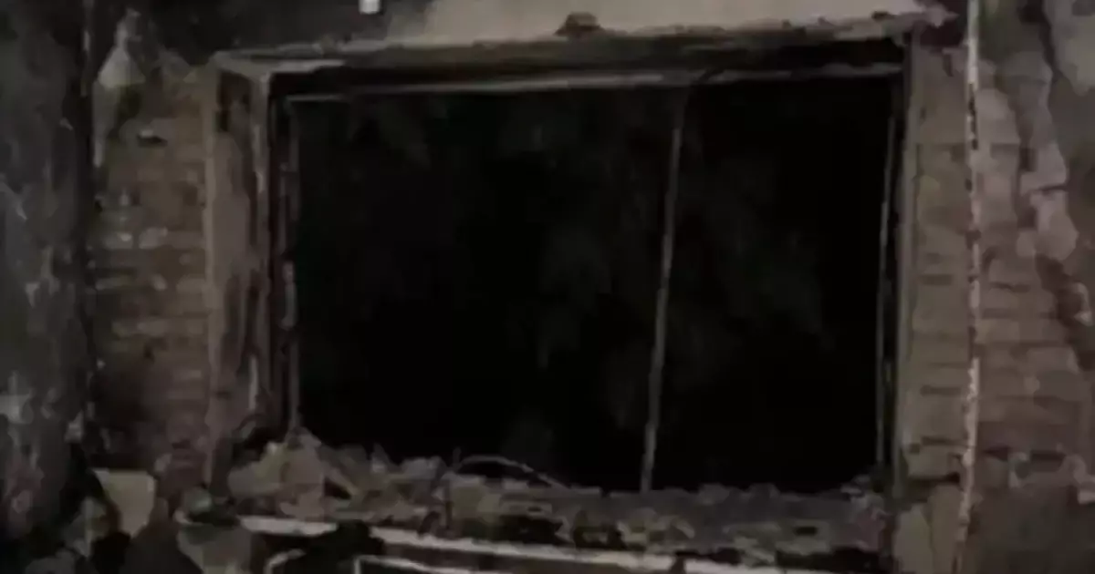 У Києві під час пожежі людина отримала опіки обличчя 1-2 ступеня