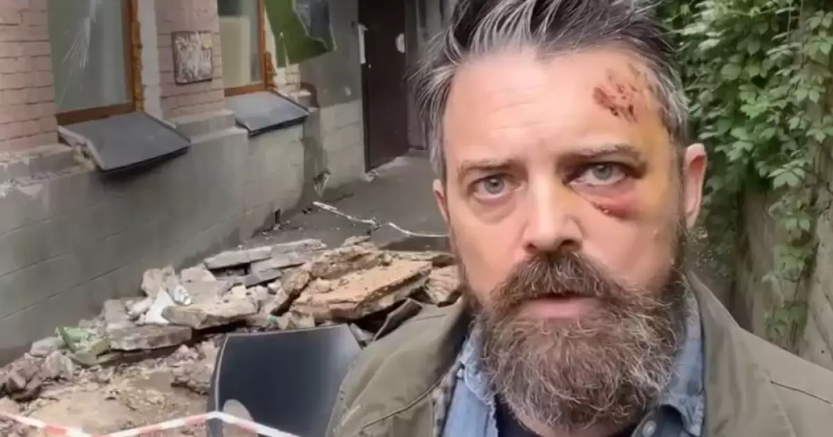 У Києві демонтували балкон, що обвалився на Подолі: що буде далі?