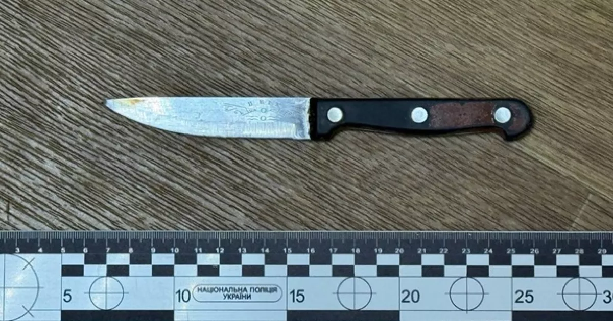 Побутовий конфлікт у Поліській громаді: 16-річний поранив 21-річного ножем у живіт