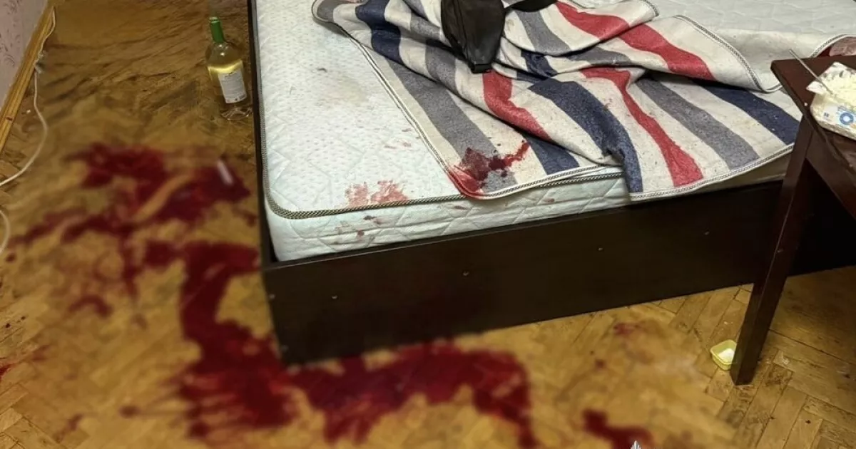 Після застілля — ножові поранення: у Києві жінка напала на співмешканця