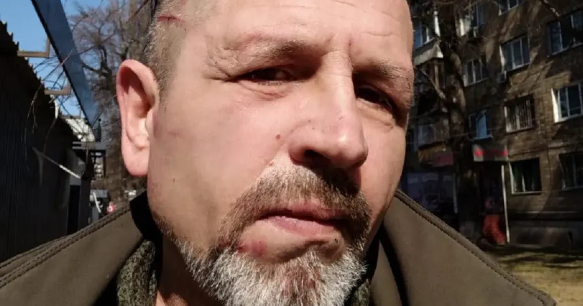 Скандал у київському ТЦК: заявляють про побиття екс-полоненого Балуха