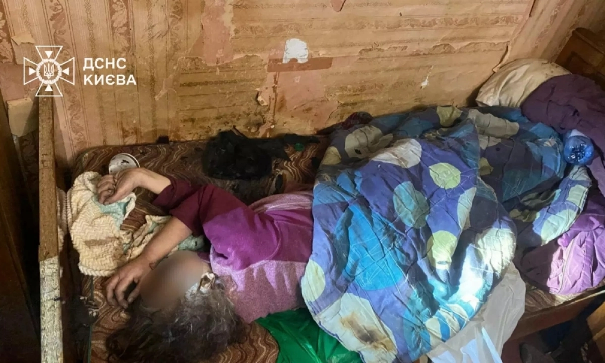 Пожежа на Харківському шосе: у Києві жінку винесли із задимленої квартири