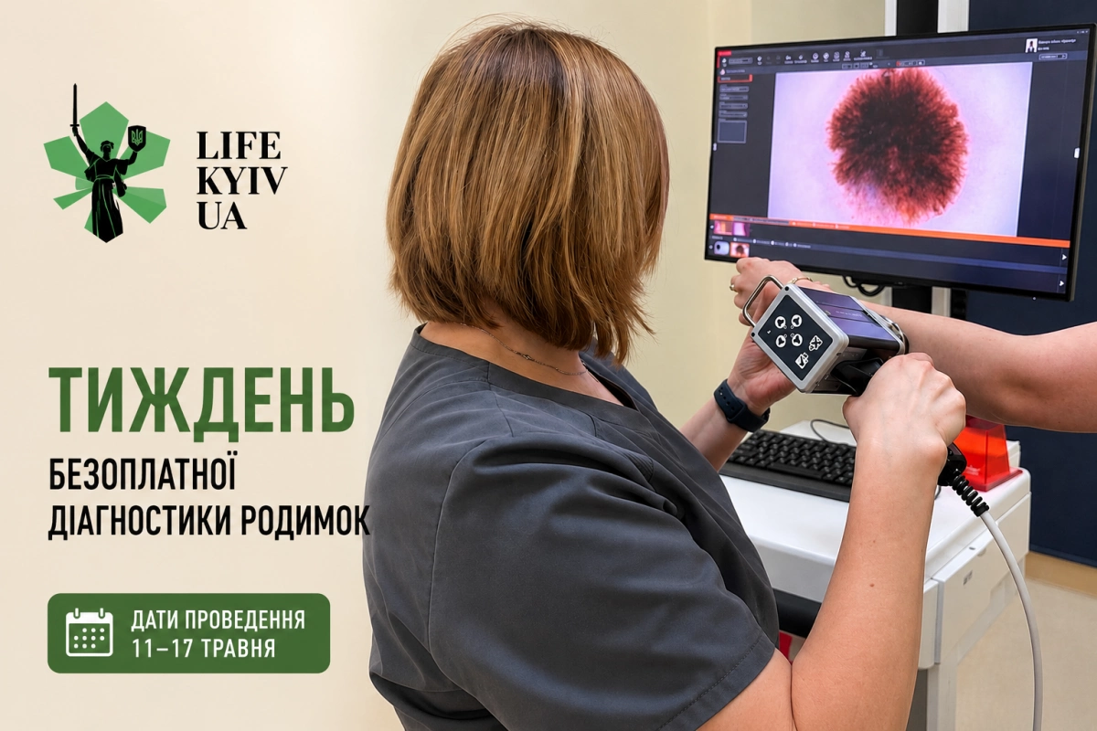 У Києві безкоштовно перевірятимуть родимки - де пройти діагностику