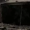 У Києві під час пожежі людина отримала опіки обличчя 1-2 ступеня