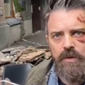 У Києві демонтували балкон, що обвалився на Подолі: що буде далі?