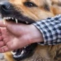 У Броварах дитина постраждала від нападу собаки — розпочато розслідування