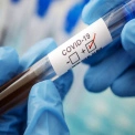 В Україні зростає кількість випадків COVID-19 — у столиці за тиждень понад 3,5 тис. нових хворих