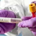 В Ірпінській громаді зафіксовано лише чотири випадки COVID-19 за тиждень