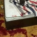 Після застілля — ножові поранення: у Києві жінка напала на співмешканця