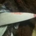 Застілля в Солом’янському районі завершилось ножовим пораненням