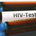 ВІЛ у Києві: нові випадки, статистика та можливості безоплатного лікування
