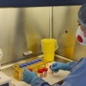 Туберкульоз відступає: у Києві захворюваність впала на 27%, але небезпека лишається