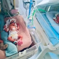 У Києві природним шляхом народилася трійня: рідкісний випадок у Перинатальному центрі