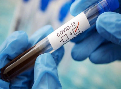 В Україні зростає кількість випадків COVID-19 — у столиці за тиждень понад 3,5 тис. нових хворих