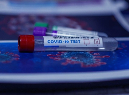 COVID-19 повертається: у Києві різкий сплеск нових випадків