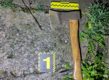 П’яна сварка на Київщині: чоловік ударив знайомого сокирою по голові