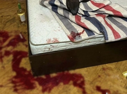 Після застілля — ножові поранення: у Києві жінка напала на співмешканця