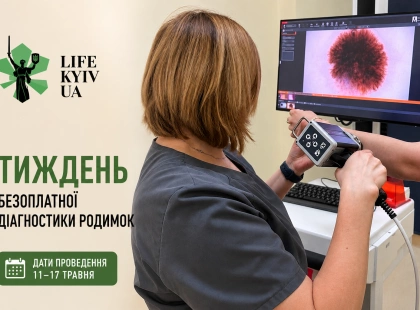 У Києві безкоштовно перевірятимуть родимки - де пройти діагностику
