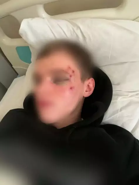 Побиття кастетом у Переяславі: родина постраждалого звинувачує поліцію у «паралічі правосуддя» - 1