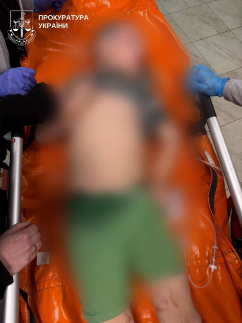 На Київщині батько побив 7-річного сина до втрати свідомості: дитина в реанімації - 3