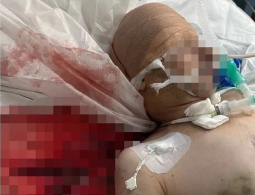 Скандал у Київській лікарні швидкої допомоги: поранений військовий чекав операції та нестача ліків - 1